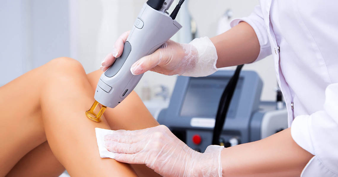 Laser hair removal